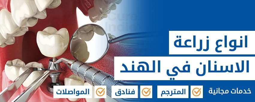 طريقة زراعة الاسنان